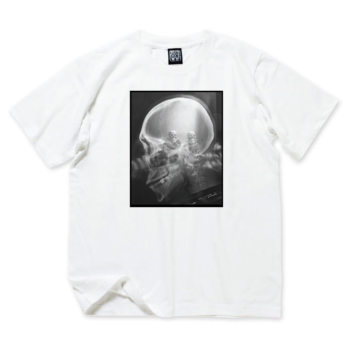 【USUGROW】X -RAY TEE ホワイト【予約商品】